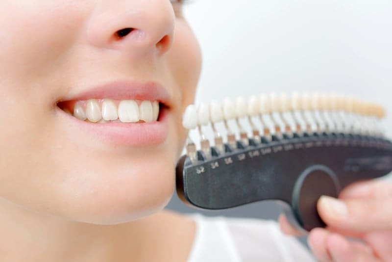 Toothy smile next to sample false teeth
